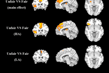 attractive female faces activates the brain's reward circuits in males