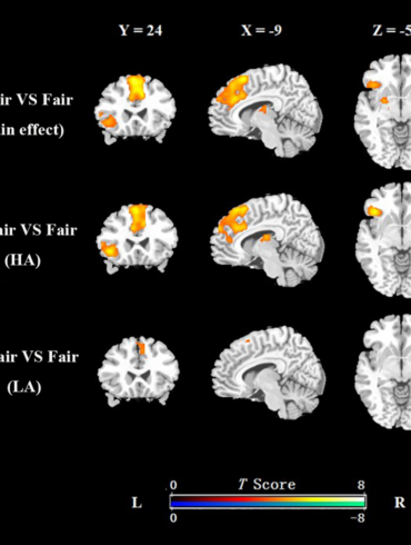 attractive female faces activates the brain's reward circuits in males