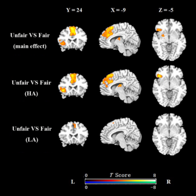 attractive female faces activates the brain's reward circuits in males