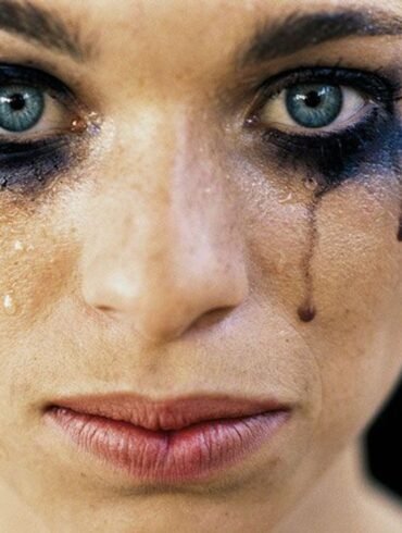 beauty has its drawbacks