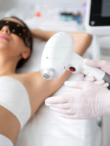 Laser Hair Removal